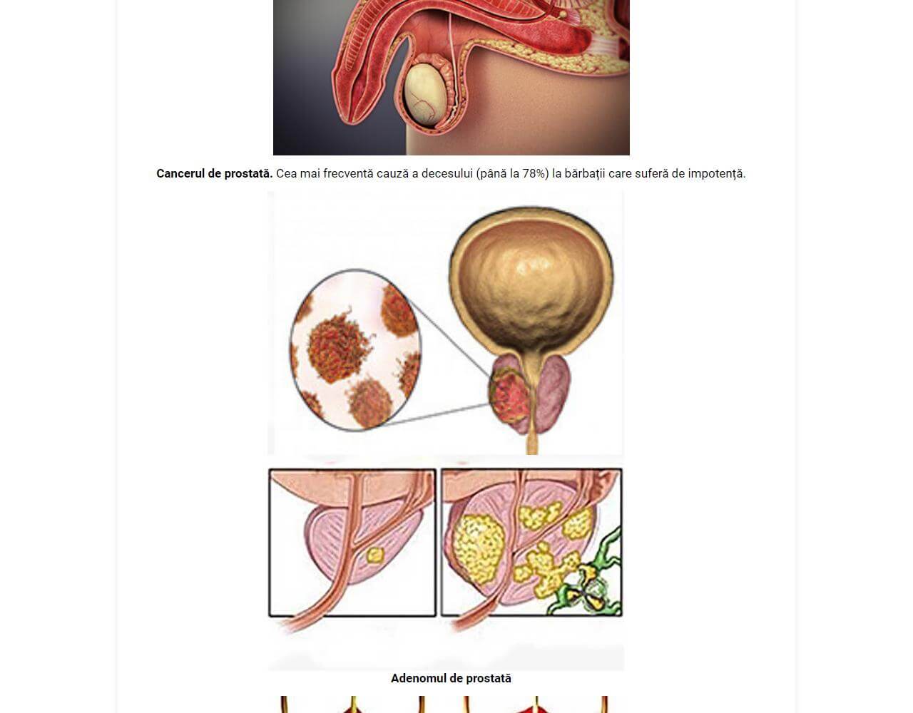 Uromexil Forte 4