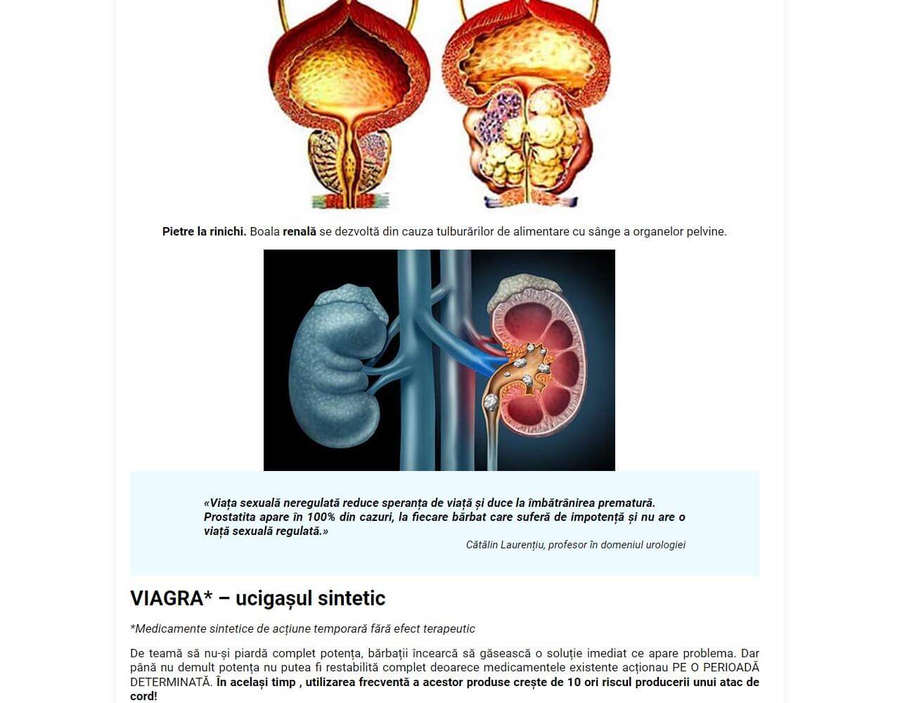 Uromexil Forte 5