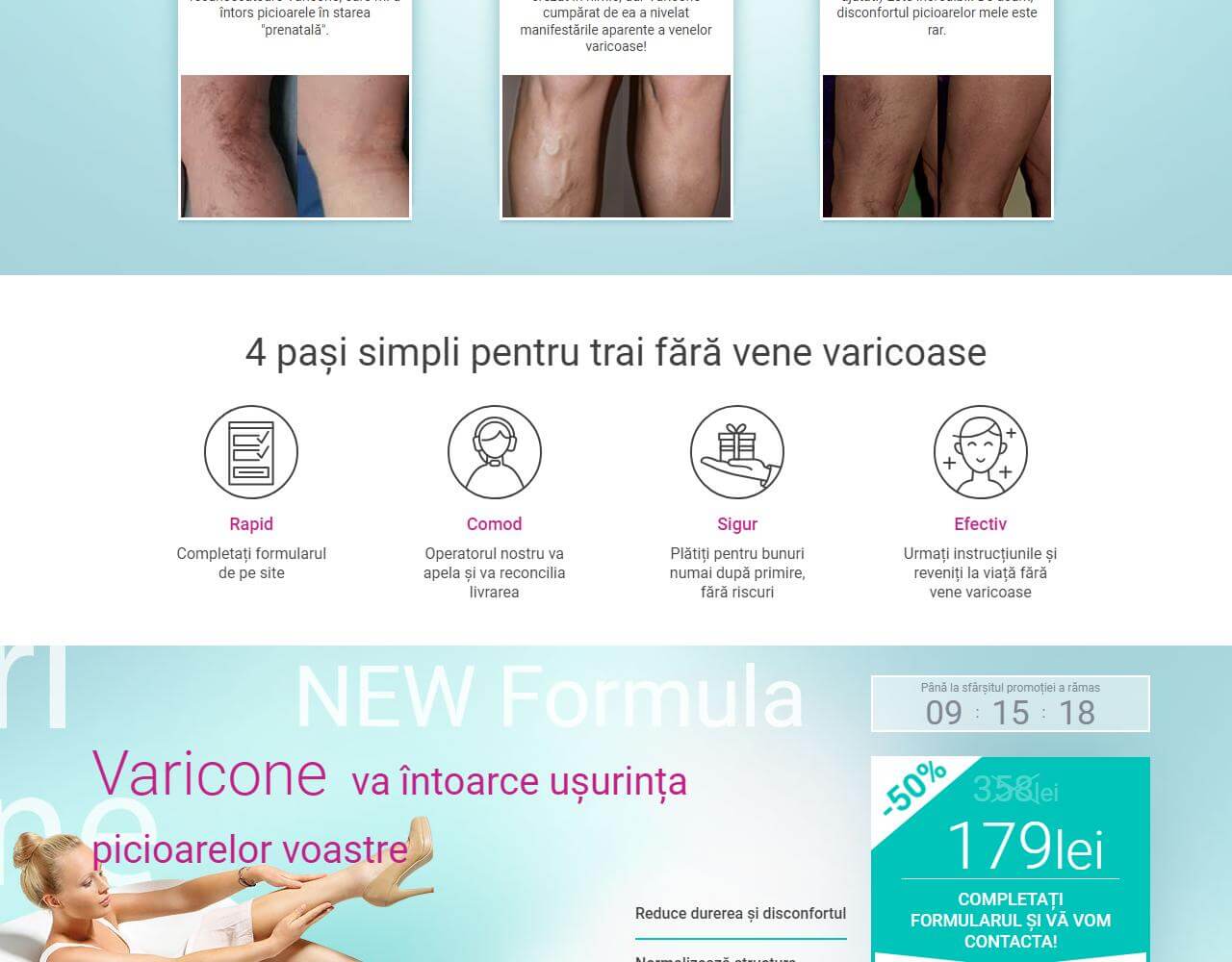 Varicone 4