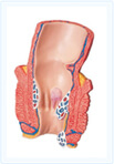 Clinica PROCTOLiNE